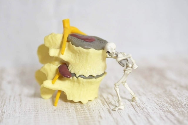 椎間板ヘルニア